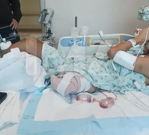 Survivor Greece Star Sues Show Producers for Over $100m After Losing Leg in Filming Accident