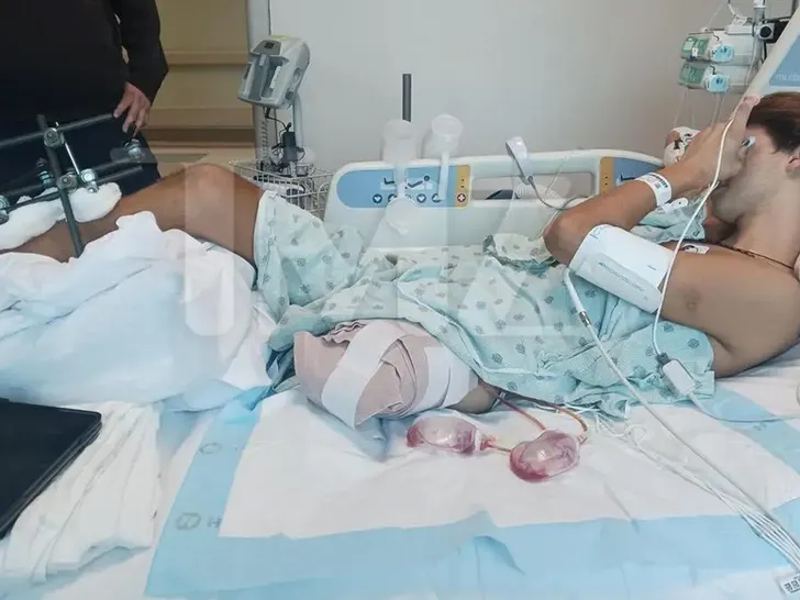 Survivor Greece Star Sues Show Producers for Over $100m After Losing Leg in Filming Accident